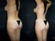 Slider image (8) Dr. Fernando Munar - Plastic Surgery